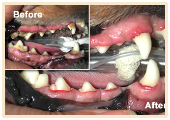 Dental Work Before/After